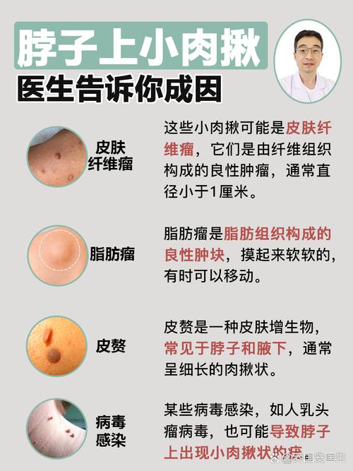 脖子上长肉疙瘩的是什么生肖,脖子上长小肉疙瘩是不是癌症的前兆